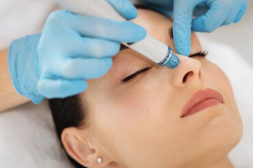 IonFusion MD Hydra-Dermabrasion